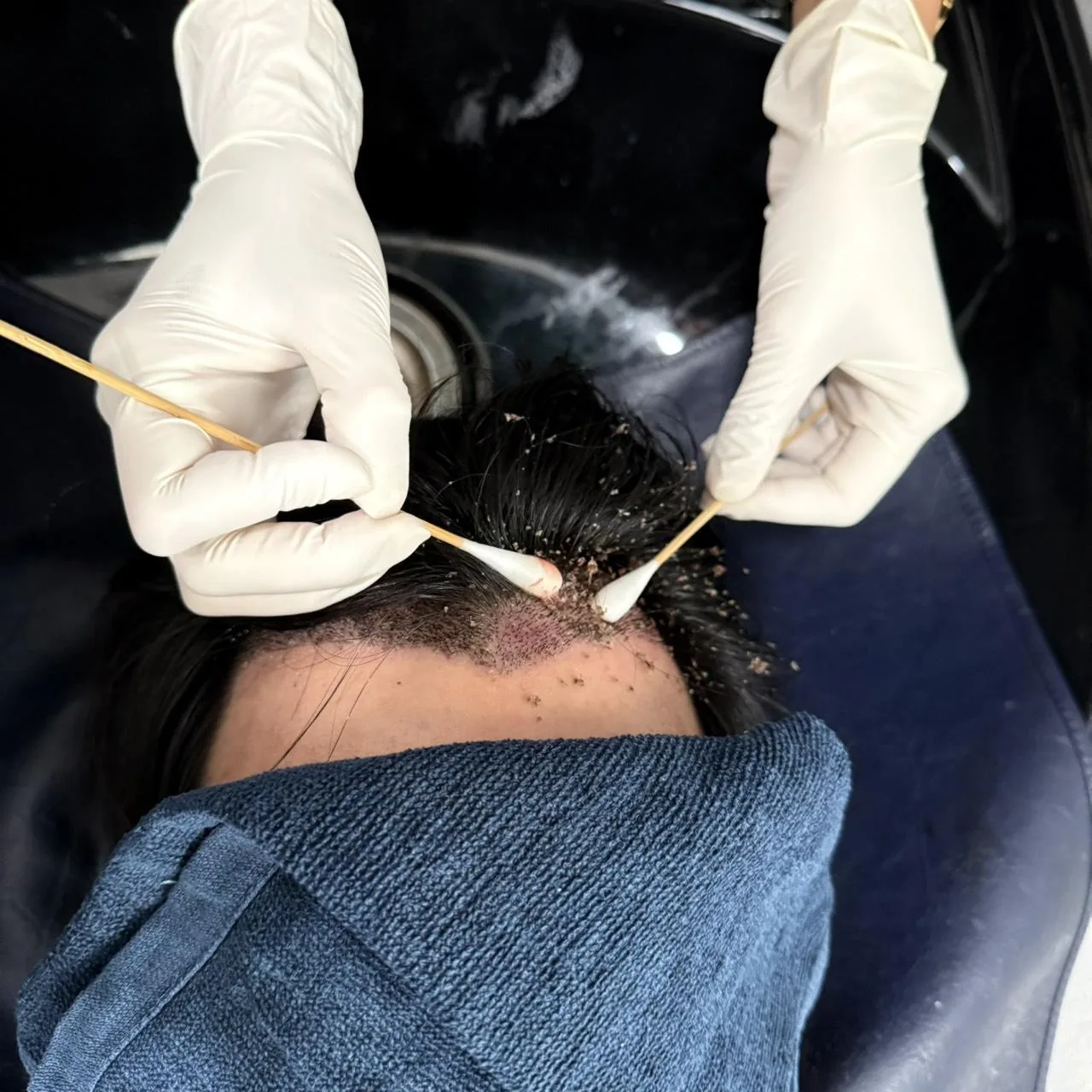 ht-14-scab-removal