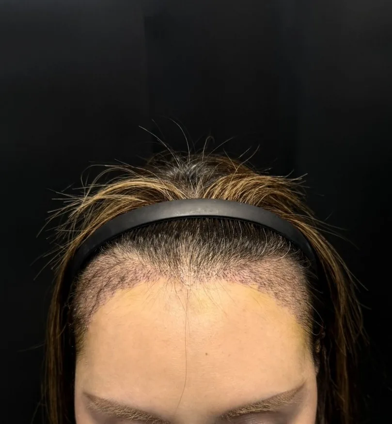 ht-17-short-hair-1