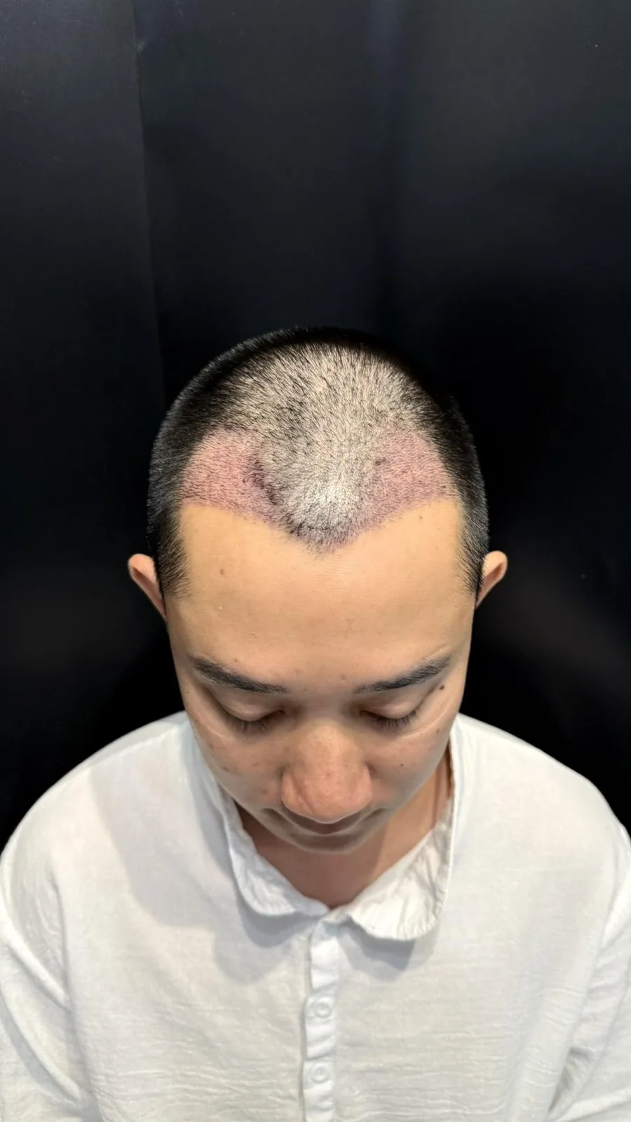 ht-18-short-hair-2